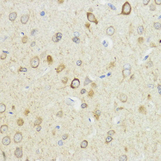 Immunohistochemistry of paraffin-embedded Rat brain using HACE1 Polyclonal Antibody at dilution of  1:100 (40x lens).