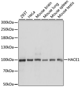 Western blot analysis of extracts of various cell lines using HACE1 Polyclonal Antibody at dilution of 1:1000.