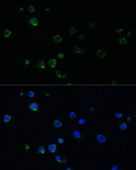 Immunofluorescence analysis of Jurkat cells using PMAIP1 Polyclonal Antibody at dilution of  1:100. Blue: DAPI for nuclear staining.