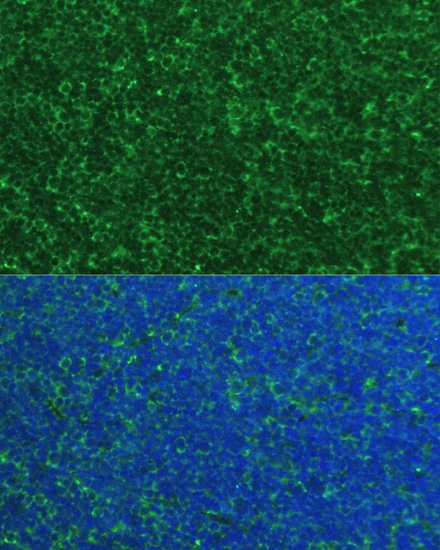 Immunofluorescence analysis of Mouse breast cells using PMAIP1 Polyclonal Antibody at dilution of  1:100. Blue: DAPI for nuclear staining.