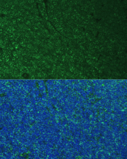 Immunofluorescence analysis of Mouse breast cells using PMAIP1 Polyclonal Antibody at dilution of  1:100. Blue: DAPI for nuclear staining.