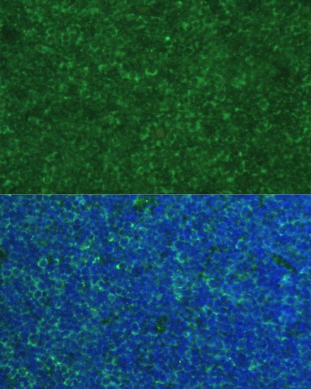Immunofluorescence analysis of Mouse breast cells using PMAIP1 Polyclonal Antibody at dilution of  1:100. Blue: DAPI for nuclear staining.