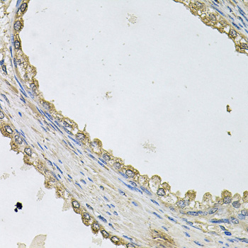 Immunohistochemistry of paraffin-embedded Human prostate using MTERFD1 Polyclonal Antibody at dilution of  1:100 (40x lens).