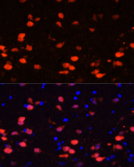 Immunofluorescence analysis of Rat brain using CALB2 Polyclonal Antibody at dilution of  1:100. Blue: DAPI for nuclear staining.