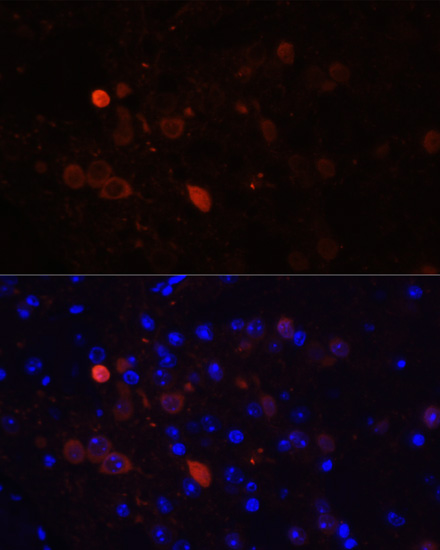 Immunofluorescence analysis of Mouse brain using CALB2 Polyclonal Antibody at dilution of  1:100. Blue: DAPI for nuclear staining.