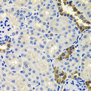 Immunohistochemistry of paraffin-embedded Mouse kidney using CALB2 Polyclonal Antibody at dilution of  1:100 (40x lens).