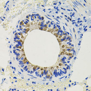 Immunohistochemistry of paraffin-embedded Mouse lung using CALB2 Polyclonal Antibody at dilution of  1:100 (40x lens).
