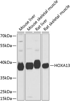 Western blot analysis of extracts of various cell lines using HOXA13 Polyclonal Antibody at dilution of 1:1000.