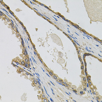 Immunohistochemistry of paraffin-embedded Human prostate using PTK7 Polyclonal Antibody at dilution of  1:100 (40x lens).