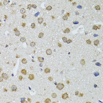 Immunohistochemistry of paraffin-embedded Mouse brain using RNASEL Polyclonal Antibody at dilution of  1:100 (40x lens).