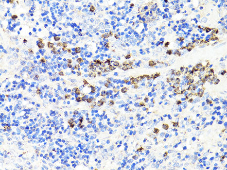 Immunohistochemistry of paraffin-embedded Rat spleen using S100A9 Polyclonal Antibody at dilution of  1:100 (40x lens).