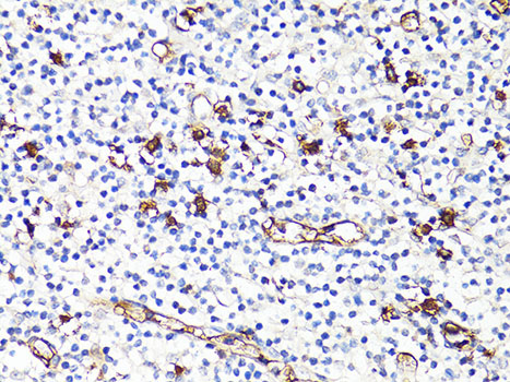 Immunohistochemistry of paraffin-embedded Human tonsil using S100A9 Polyclonal Antibody at dilution of  1:100 (40x lens).