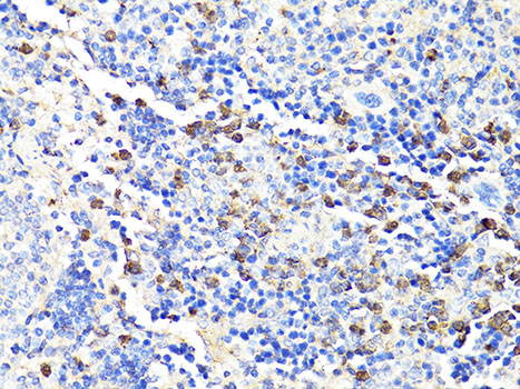 Immunohistochemistry of paraffin-embedded Mouse spleen using S100A9 Polyclonal Antibody at dilution of  1:100 (40x lens).