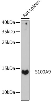 Western blot analysis of extracts of Rat spleen using S100A9 Polyclonal Antibody at dilution of 1:1000.