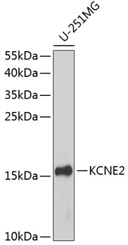 Western blot analysis of extracts of U-251MG cells using KCNE2 Polyclonal Antibody at dilution of 1:1000.
