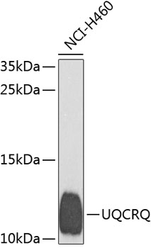 Western blot analysis of extracts of H460 cells using UQCRQ Polyclonal Antibody at dilution of 1:1000.
