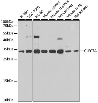 Western blot analysis of extracts of various cell lines using CLEC7A Polyclonal Antibody at dilution of 1:1000.