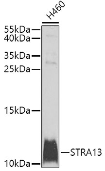 Western blot analysis of extracts of H460 cells using STRA13 Polyclonal Antibody at dilution of 1:1000.