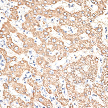 Immunohistochemistry of paraffin-embedded Human liver using KIR3DS1 Polyclonal Antibody at dilution of  1:100 (40x lens).