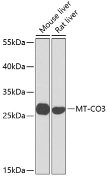 Western blot analysis of extracts of various cell lines using MT-CO3 Polyclonal Antibody at dilution of 1:1000.