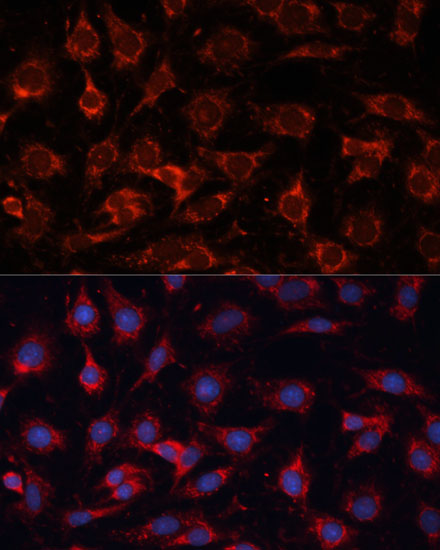 Immunofluorescence analysis of C6 cells using PDHA2 Polyclonal Antibody at dilution of  1:100 (40x lens). Blue: DAPI for nuclear staining.