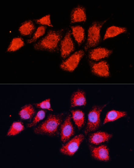 Immunofluorescence analysis of HeLa cells using PDHA2 Polyclonal Antibody at dilution of  1:100 (40x lens). Blue: DAPI for nuclear staining.