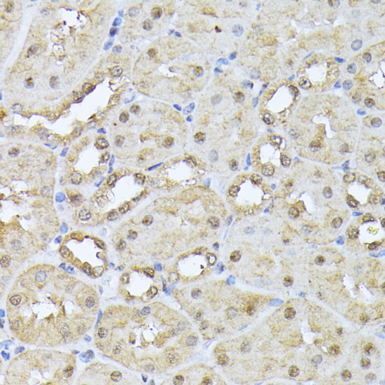 Immunohistochemistry of paraffin-embedded Mouse kidney using PSMB3 Polyclonal Antibody at dilution of  1:100 (40x lens).