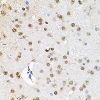 Immunohistochemistry of paraffin-embedded Rat brain using BAF60a Polyclonal Antibody at dilution of  1:100 (40x lens).