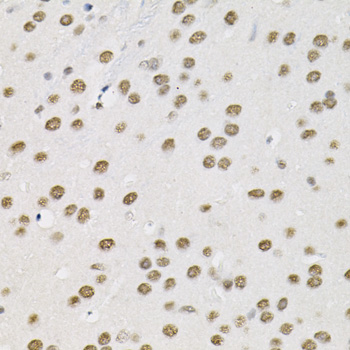 Immunohistochemistry of paraffin-embedded Mouse brain using BAF60a Polyclonal Antibody