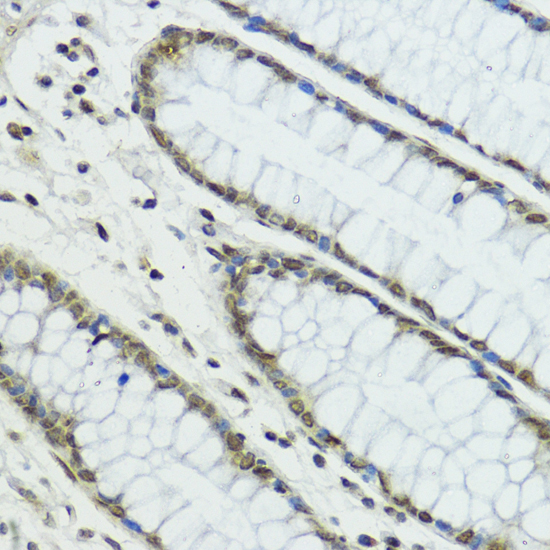 Immunohistochemistry of paraffin-embedded Human colon using TRIP12 Polyclonal Antibody at dilution of  1:100 (40x lens).