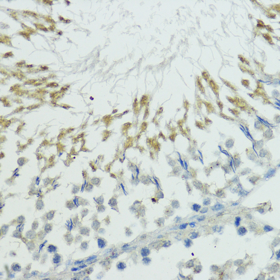Immunohistochemistry of paraffin-embedded Rat testis using TRIP12 Polyclonal Antibody at dilution of  1:100 (40x lens).
