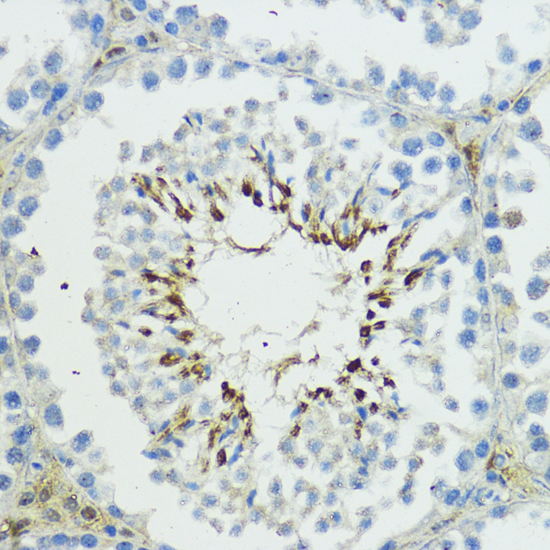Immunohistochemistry of paraffin-embedded Mouse testis using TRIP12 Polyclonal Antibody at dilution of  1:100 (40x lens).