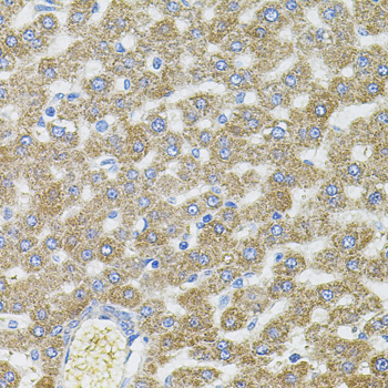 Immunohistochemistry of paraffin-embedded Rat liver using CEP164 Polyclonal Antibody
