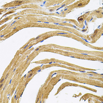 Immunohistochemistry of paraffin-embedded Rat heart using CEP164 Polyclonal Antibody