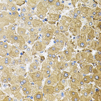 Immunohistochemistry of paraffin-embedded Human liver damage using CEP164 Polyclonal Antibody