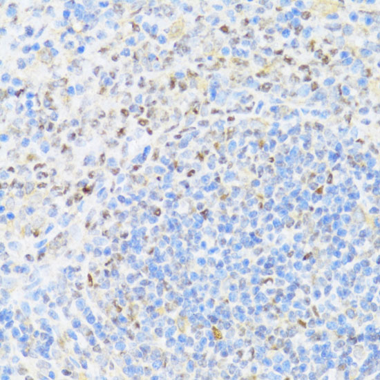 Immunohistochemistry of paraffin-embedded Rat spleen using UQCC2 Polyclonal Antibody at dilution of  1:100 (40x lens).