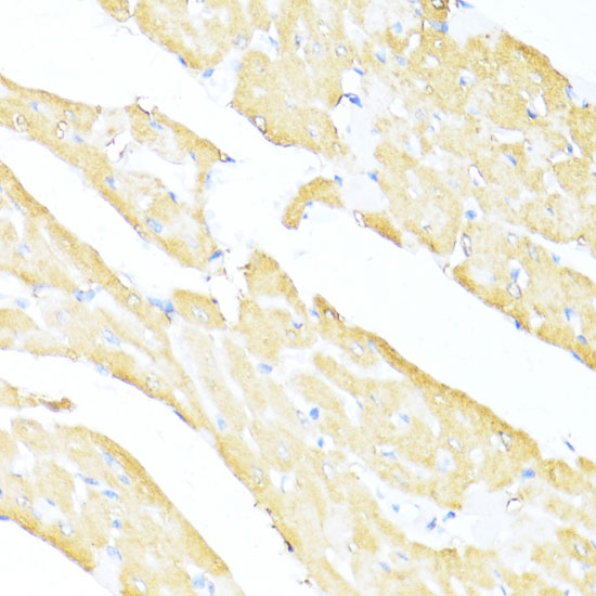 Immunohistochemistry of paraffin-embedded Rat heart using UQCC2 Polyclonal Antibody at dilution of  1:100 (40x lens).