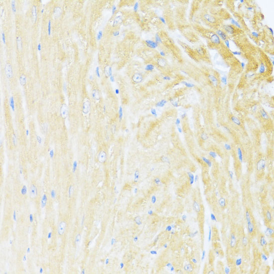 Immunohistochemistry of paraffin-embedded Mouse heart using UQCC2 Polyclonal Antibody at dilution of  1:100 (40x lens).