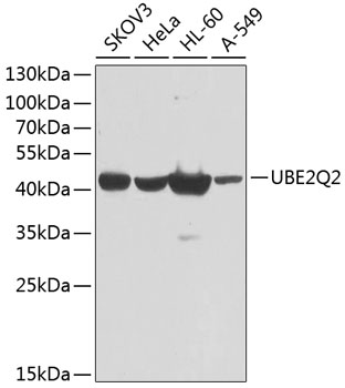 Western blot analysis of extracts of various cell lines using UBE2Q2 Polyclonal Antibody at dilution of 1:1000.