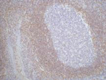 Immunohistochemistry of paraffin-embedded Human tonsil tissue using BCL2 Monoclonal Antibody at dilution of 1:200.