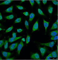 Immunofluorescence analysis of Hela tissue using HSP70 Monoclonal Antibody at dilution of 1:100.