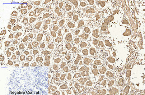 Immunohistochemistry of paraffin-embedded Human stomach tissue using AMACR Monoclonal Antibody at dilution of 1:200.