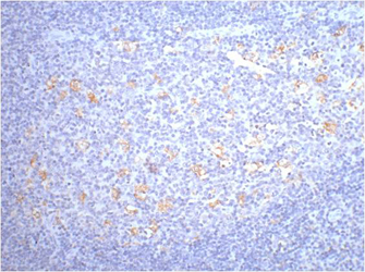 Immunohistochemistry of paraffin-embedded Human tonsil tissue using CD68 Monoclonal Antibody at dilution of 1:200.