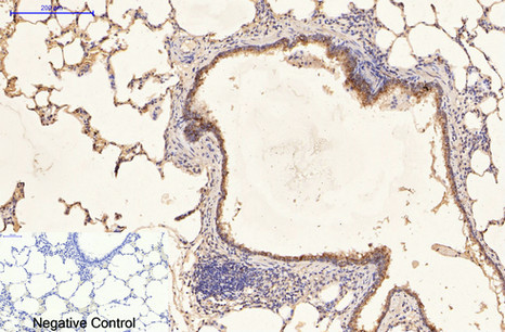 Immunohistochemistry of paraffin-embedded Rat lung tissue using CK-16 Monoclonal Antibody at dilution of 1:200.