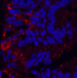 Immunofluorescence analysis of Mouse colon tissue using KIF7 Monoclonal Antibody at dilution of 1:200.