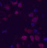 Immunofluorescence analysis of Rat brain tissue using KI67 Monoclonal Antibody at dilution of 1:200.