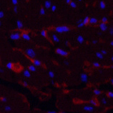 Immunofluorescence analysis of Mouse heart tissue using CD1A Monoclonal Antibody at dilution of 1:200.