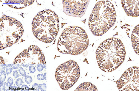 Immunohistochemistry of paraffin-embedded Mouse testis tissue using EFHD1 Monoclonal Antibody at dilution of 1:200.