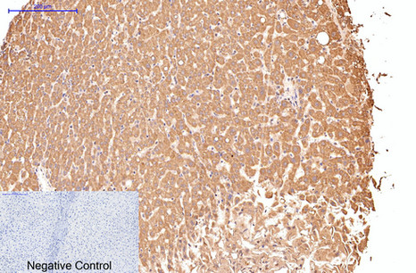 Immunohistochemistry of paraffin-embedded Human liver tissue using CD16 Monoclonal Antibody at dilution of 1:200.