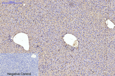 Immunohistochemistry of paraffin-embedded Mouse liver tissue using ACTA1 Monoclonal Antibody at dilution of 1:200.